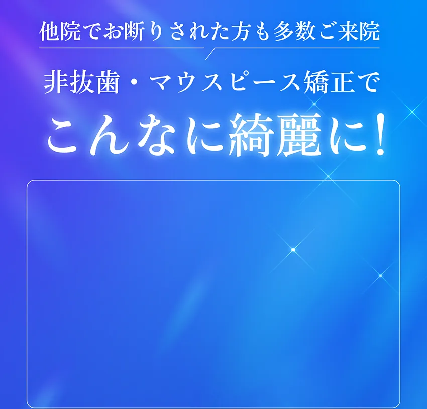 非抜歯・マウスピース矯正でこんな綺麗に