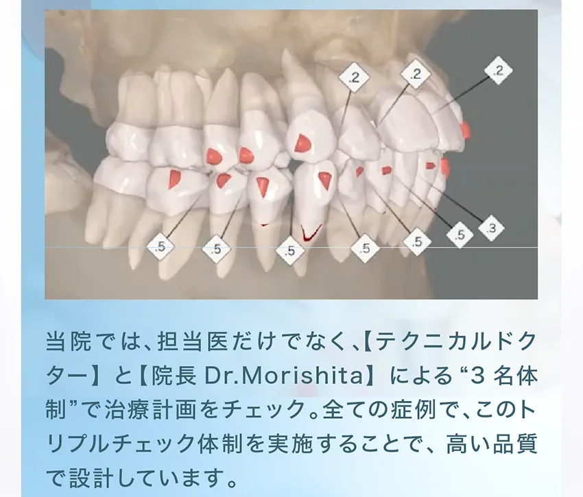 説明