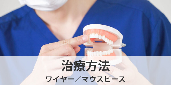 矯正歯科選びのポイント治療方法