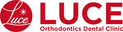 ルーチェマウスピース矯正歯科