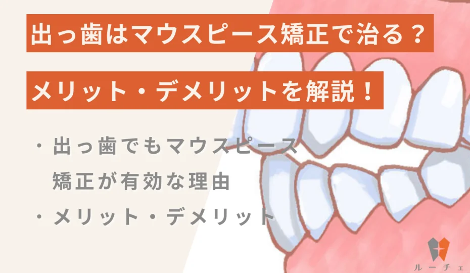 出っ歯はマウスピース矯正で治る?メリット・デメリットを解説