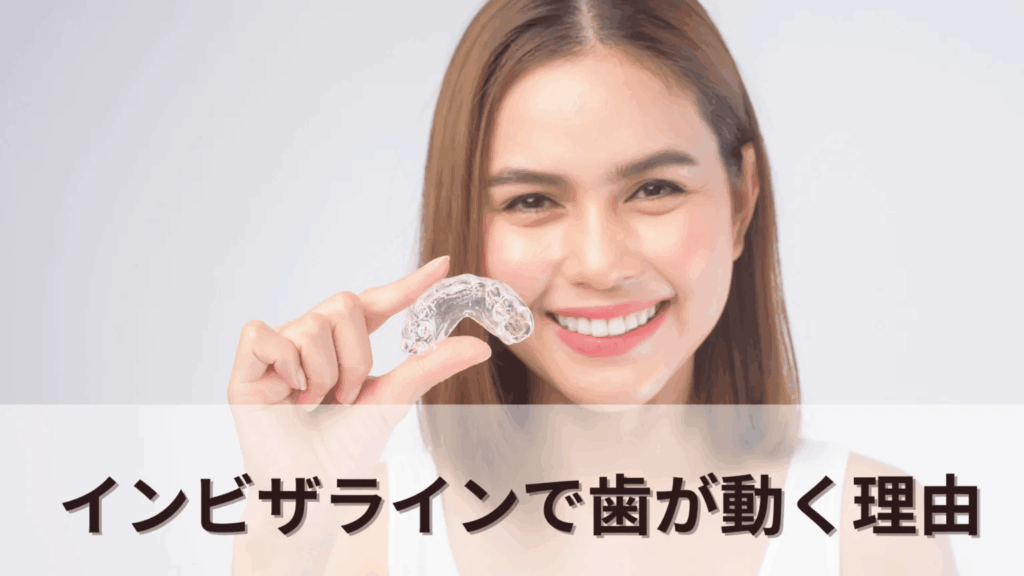 インビザラインで歯が動く理由