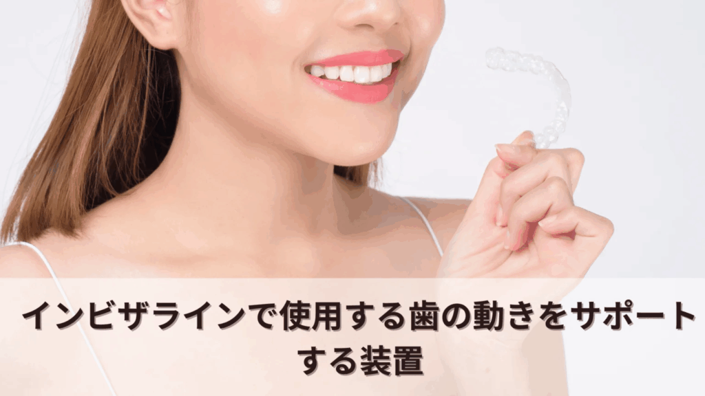 インビザラインで使用する歯の動きをサポートする装置
