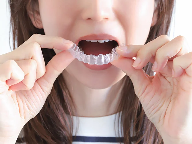 image | ルーチェマウスピース矯正歯科 インビザラインはこんな人におすすめ