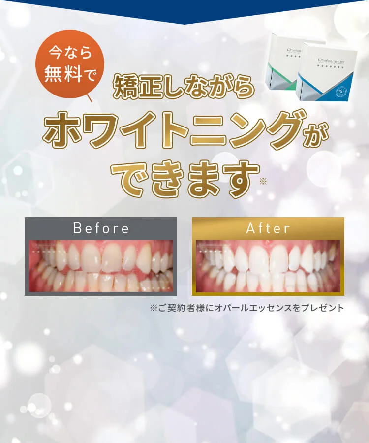 ホワイトニングができます