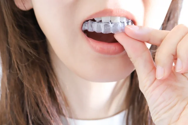 リテーナーの装着期間について