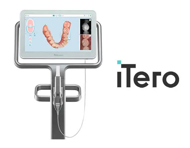 image | ルーチェマウスピース矯正歯科 iTero element