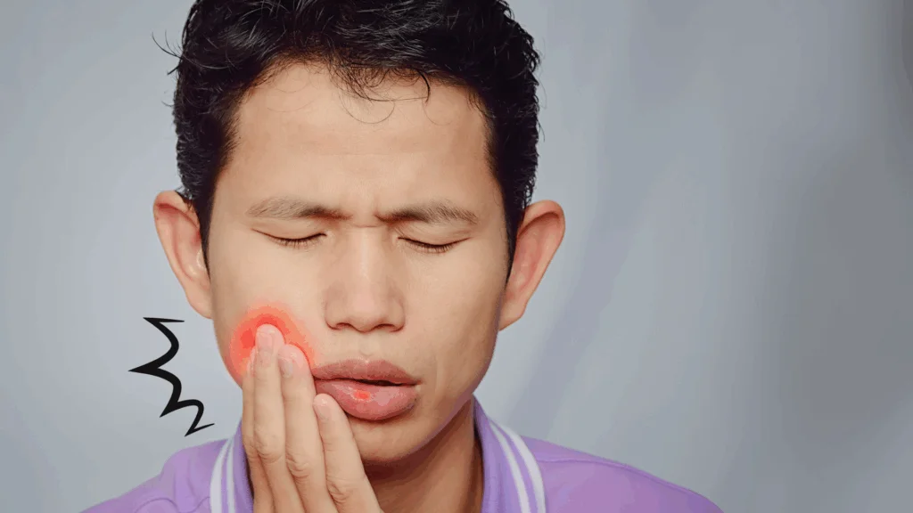 インビザライン治療中に口内炎ができる原因とは？