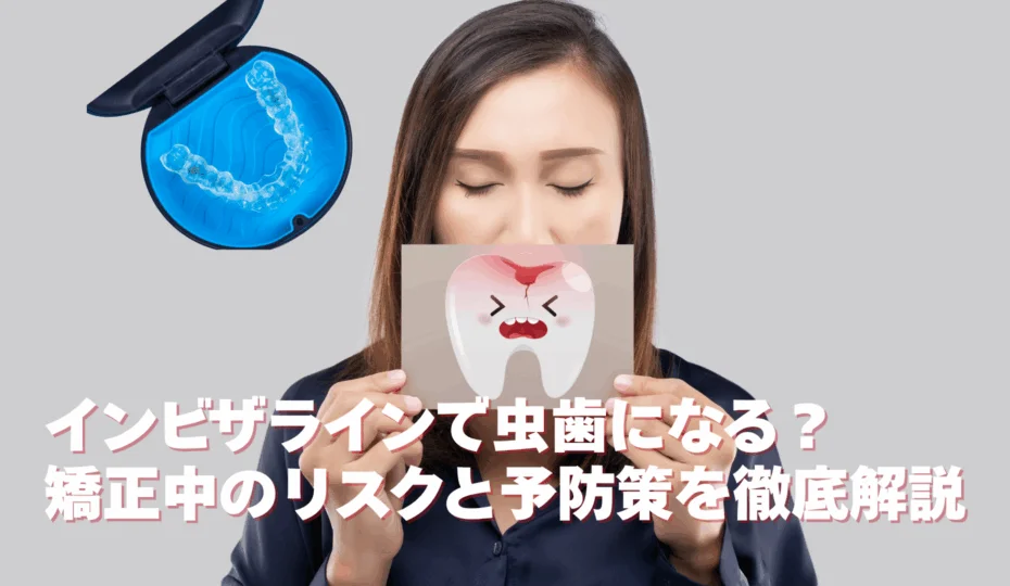 インビザラインで虫歯になる？ 矯正中のリスクと予防策を徹底解説