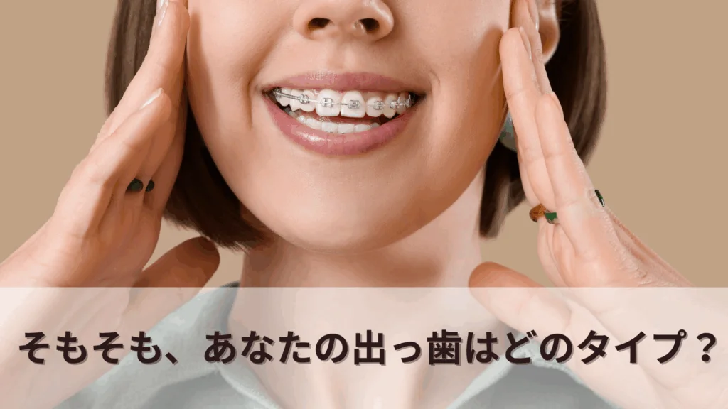 マウスピース矯正の種類-22-1024x576 | ルーチェマウスピース矯正歯科 そもそも、あなたの出っ歯はどのタイプ?