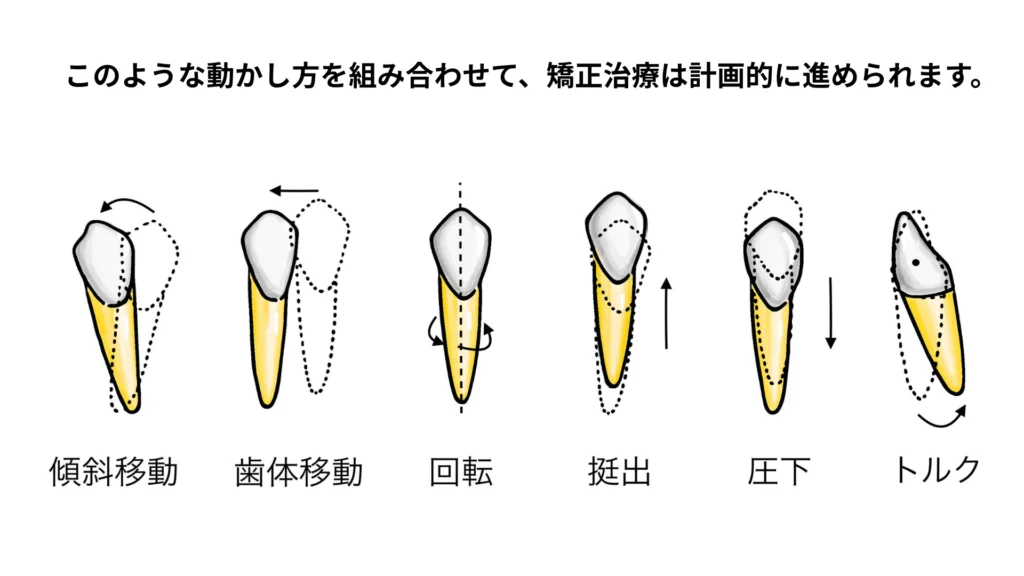 | ルーチェマウスピース矯正歯科 歯の動き
