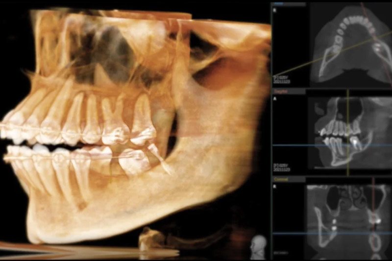 マウスピース矯正専門クリニックとして