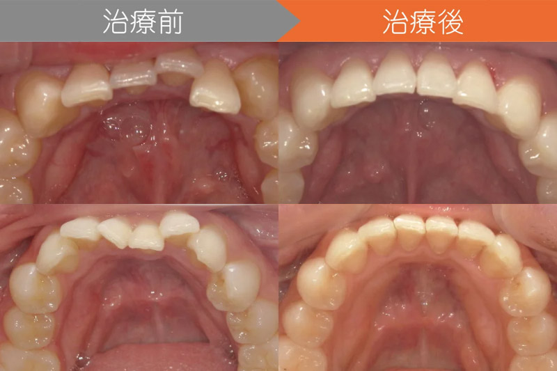 治療の“その先”にある笑顔の変化を