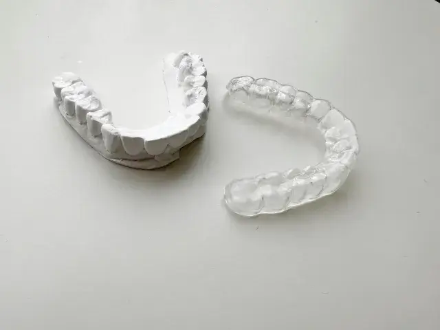 mousepice-crowding-image2 | ルーチェマウスピース矯正歯科 ワイヤー矯正との使い分け