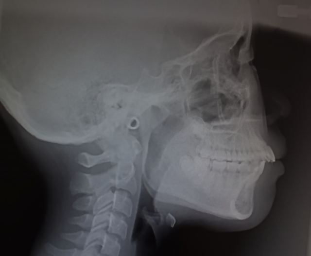 治療前に確認すべきポイント